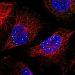 TIP120B Antibody, Novus Biologicals:Antibodies:Primary Antibodies